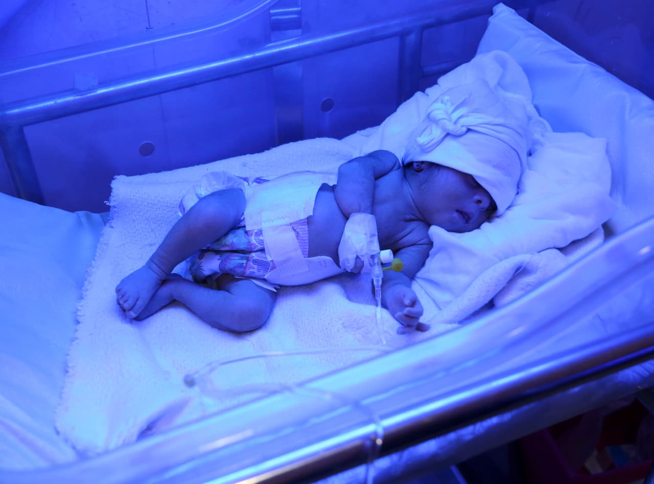 La cuarta causa de muerte por 'heridas no intencionales' está catalogada como 'sin especificar' (6,930) y la sexta es la sofocación no intencional (6,914). Dos tercios de los niños menores de un año mueren debido a sofocación (16 veces más que el resto de los grupos etarios). Según la organización 
<a href="https://www.safekids.org/suffocation-prevention-and-sleep-safety"><u>SafeKids Worldwide</u></a>, 70% de estas muertes en infantes ocurren por sofocación accidental o estrangulamiento en la cama.