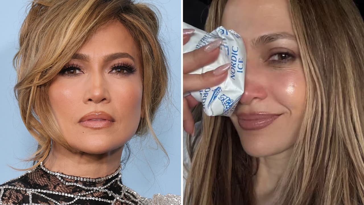 Jennifer Lopez aparece con fuerte lesión en rostro: tuvieron que suturarla