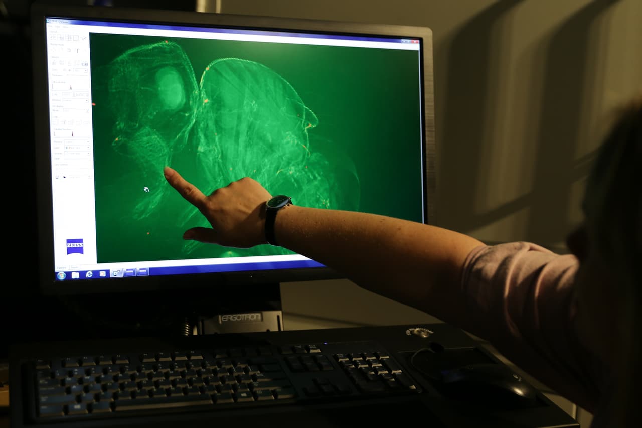 A scientist points at the mouth of a fly pictured with a high resolution 3D X-Ray picture with a Zeiss Xradia Versa family microscope inside a laboratory during a media preview at the new Francis Crick Institute building in central London on September 1, 2016. The first scientists have moved into the new £650 million Francis Crick Institute building in London and are starting work in their purpose-built labs. Next to St Pancras station and the British Library, the Crick will be the biggest biomedical research institute under one roof in Europe. / AFP / DANIEL LEAL-OLIVAS (Photo credit should read DANIEL LEAL-OLIVAS/AFP/Getty Images)