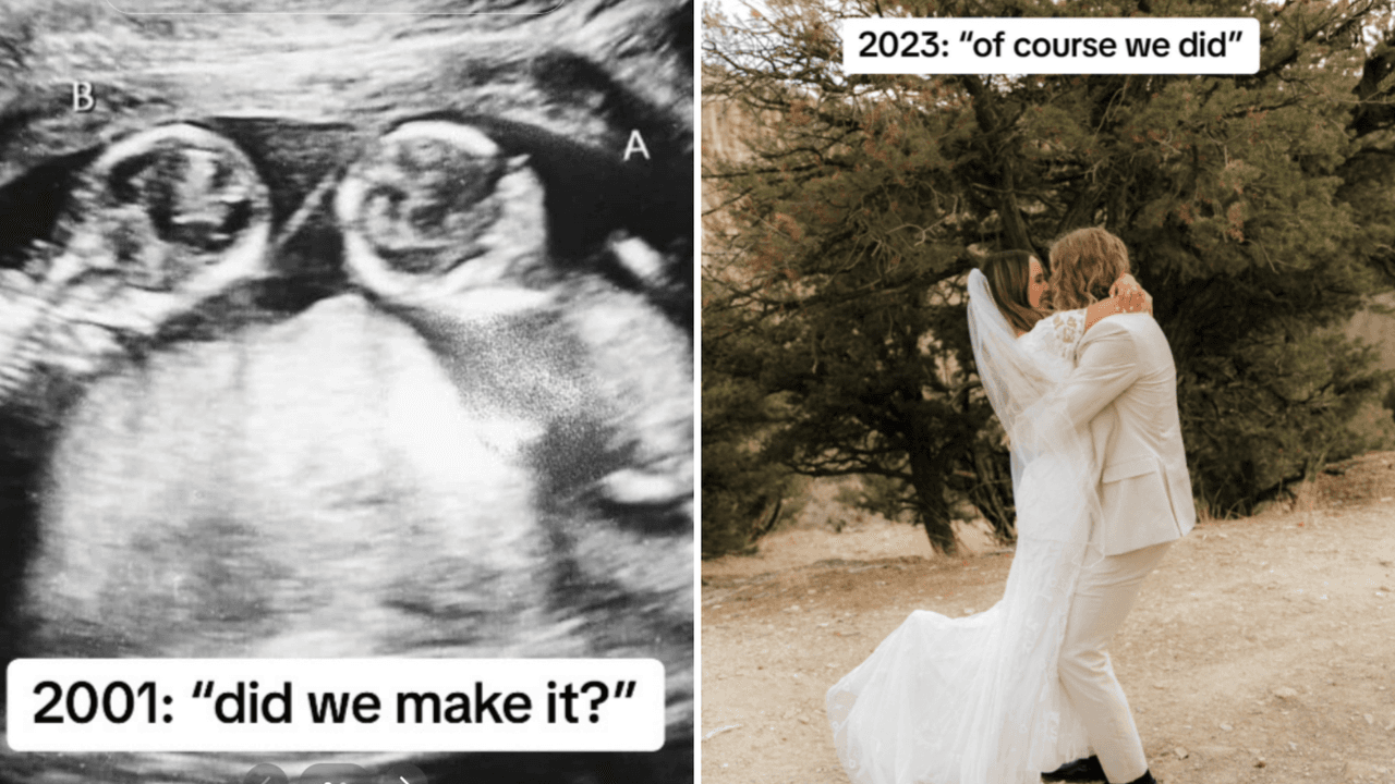 Jamie Birrell se hizo viral por contar que se casó con su hermano