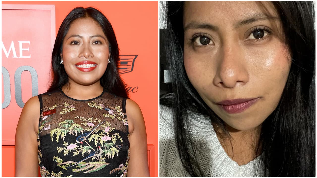 Yalitza Aparicio padece una enfermedad incurable en la piel, así la ha combatido