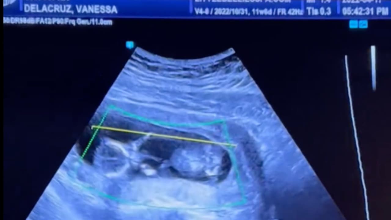 En un video compartido en su cuenta de Facebook, Byron Carrillo muestra un examen médico junto a Vanessa De La Cruz, quien estaba embarazada de Logan, el pequeño que perdería la vida un año más tarde a manos de su propio padre.