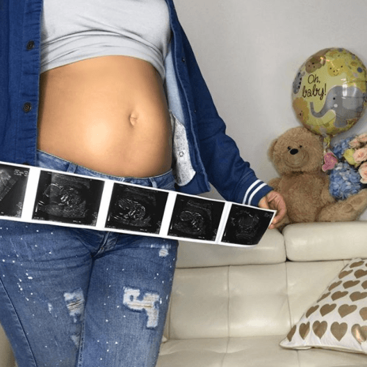 El 8 de enero de 2018, Ana Patricia compartió con la audiencia de Despierta América la noticia de su segundo embarazo. Un anuncio que acompañó con las imágenes del ultrasonido del futuro hermanito o hermanita de Giulietta. Ese momento fue el último de una larga serie de instantes de la vida de la conductora, que han quedado para siempre vinculados con el show.