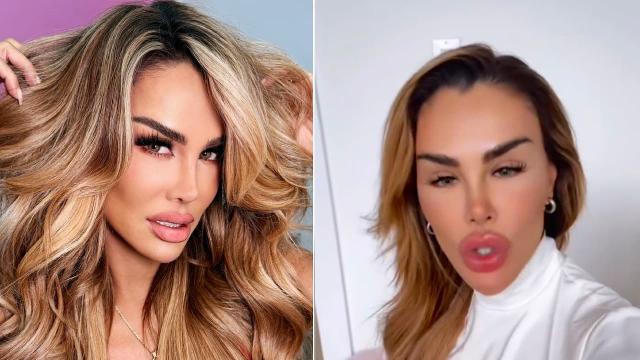 Ninel Conde confiesa que se hará otras dos cirugías estéticas: estos serán sus nuevos ‘arreglitos’