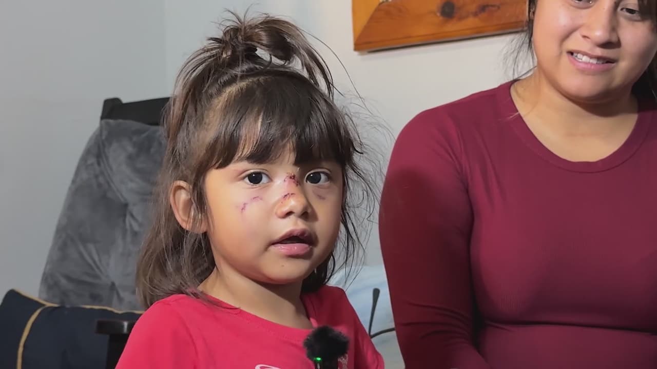 Arrestan a hombre por atacar y morder a niña de 3 años en San Antonio