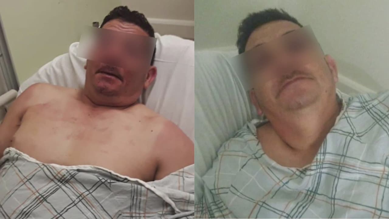 “Dijeron que no querían hispanos ahí”: hondureño es golpeado brutalmente en posible ataque racista