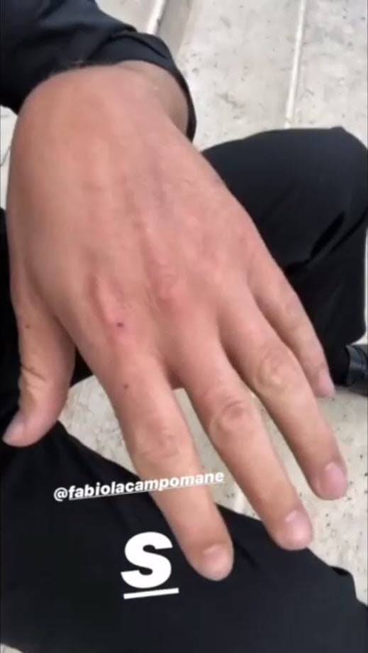 En otro video, Jonathan Islas dio su versión de los hechos: "Como pueden ver estoy lleno de sangre. Se levantó, 
<b>estaba yo durmiendo con ella, se levantó y me empezó a pegar</b>, tengo sangre en la boca, tengo sangre en los labios, tengo sangre en los brazos".