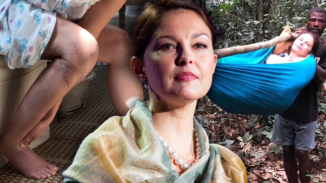 Ashley Judd muestra las cicatrices que le dejó el accidente que hace 2 meses sufrió en África 