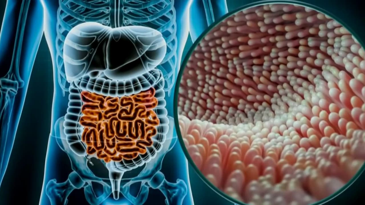 ¿Qué es la ciclosporiasis y cómo se contagia una persona? Hay 145 casos en 17 estados de EEUU
