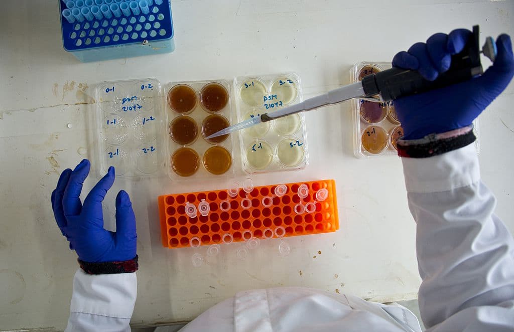 La "bacteria pesadilla" resistente a antibióticos está en al menos 27 estados del país