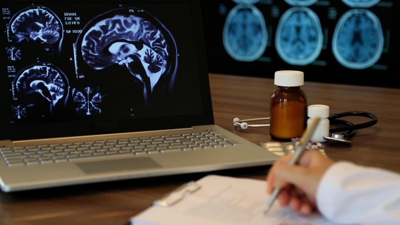 Infectarse con coronavirus podría encoger el cerebro y afectar la memoria, según estudio