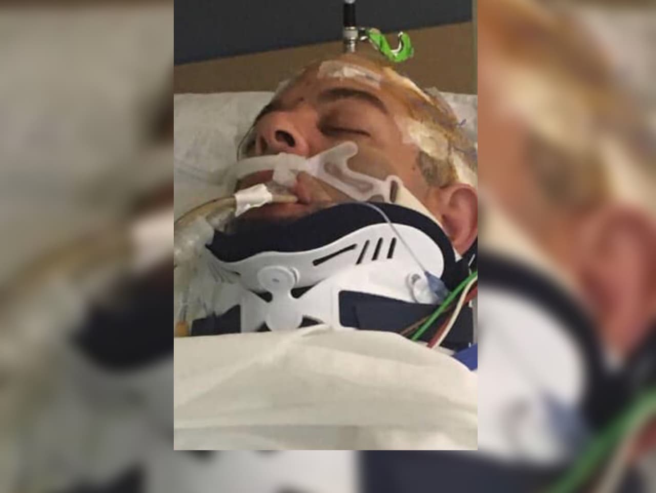 Un hombre de Filadelfia está en coma tras ser brutalmente golpeado fuera de un bar