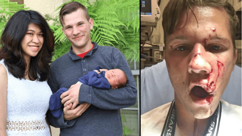 Un perro pitbull ataca al rostro a un joven que pedía donativos