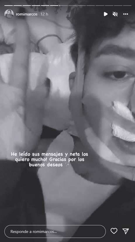El médico le dijo a Romina que su nariz había quedado "perfecta, muy bonita".
<br>