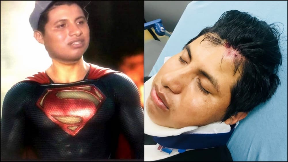 Y así lo hizo. Volvió a las calles como vendedor ambulante y a menos de un año nuevamente fue víctima de un ataque. Esta vez Benjamín Ramírez, apodado en memes como 'Elote Man', terminó hospitalizado.