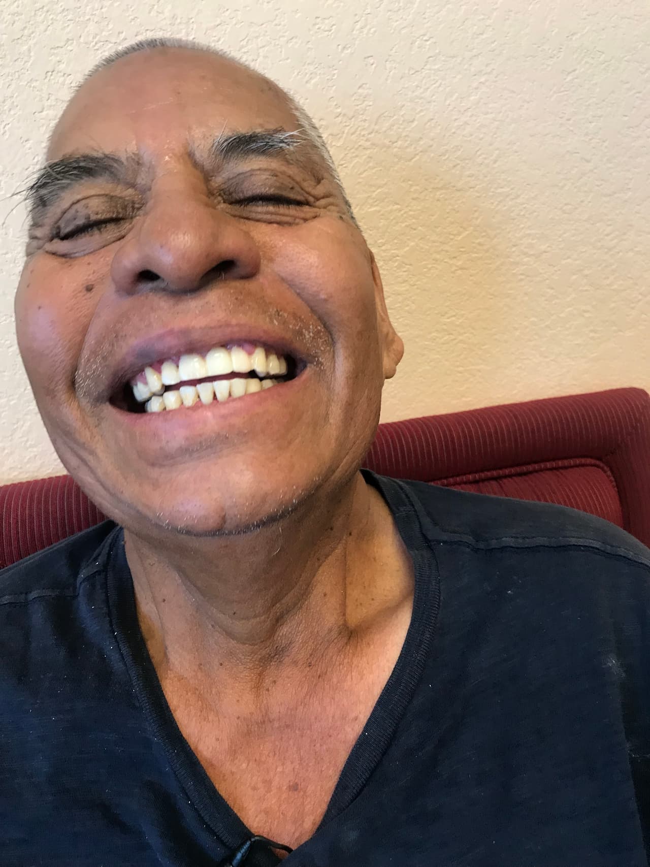 Arcadio recuperó la sonrisa después de un violento ataque del que todavía no se tienen culpables. Tanto la policía como familiares de la víctima 
<a href="https://www.univision.com/local/los-angeles-kmex/golpean-a-vendedor-ambulante-para-robarle-80-dolares-en-los-angeles">piden la colaboración de la comunidad para identificar a los atacantes</a>.