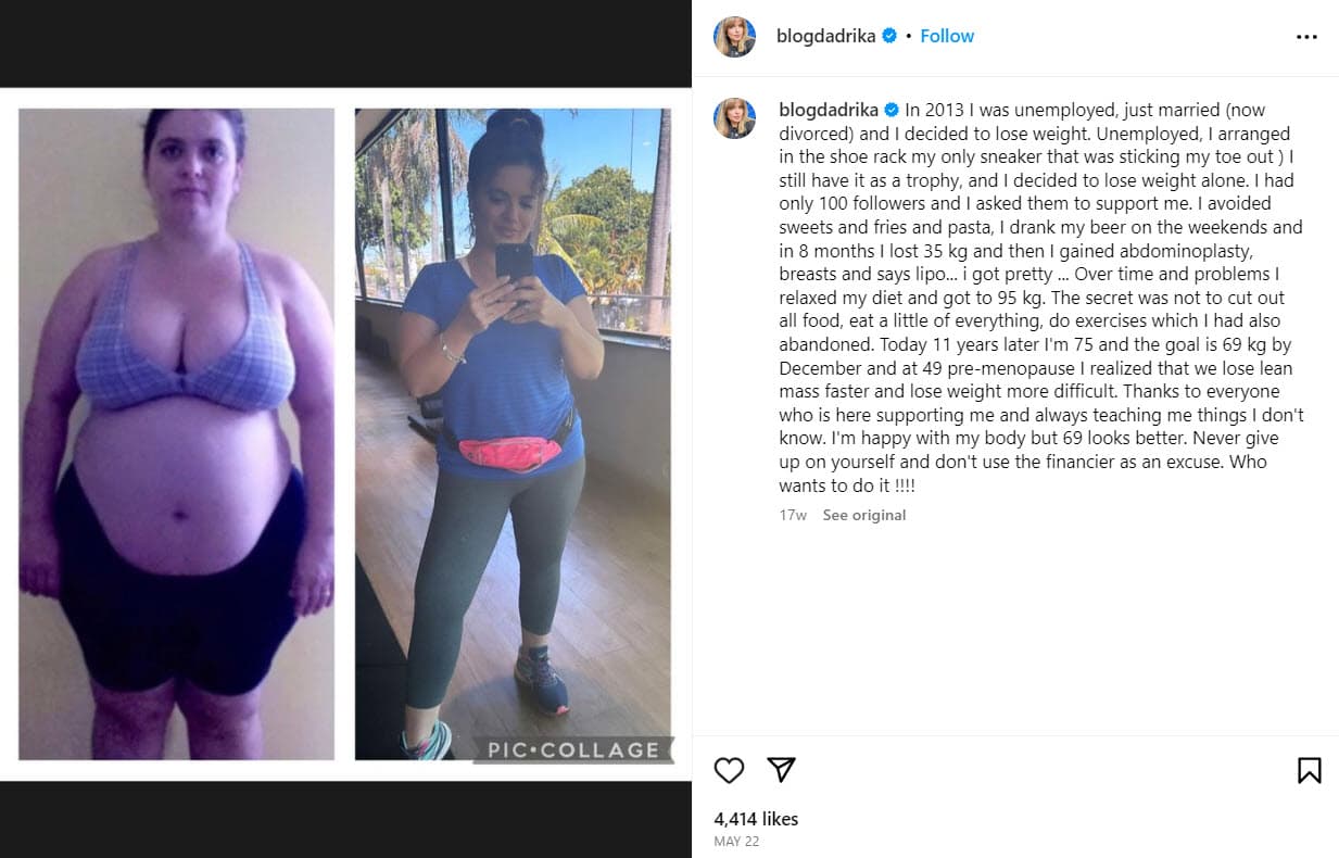 Adriana Thyssen antes y después.