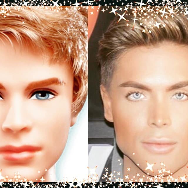 Volvió a empezar su reconstrucción facial, pero siempre quedando a la sombra de Celso.