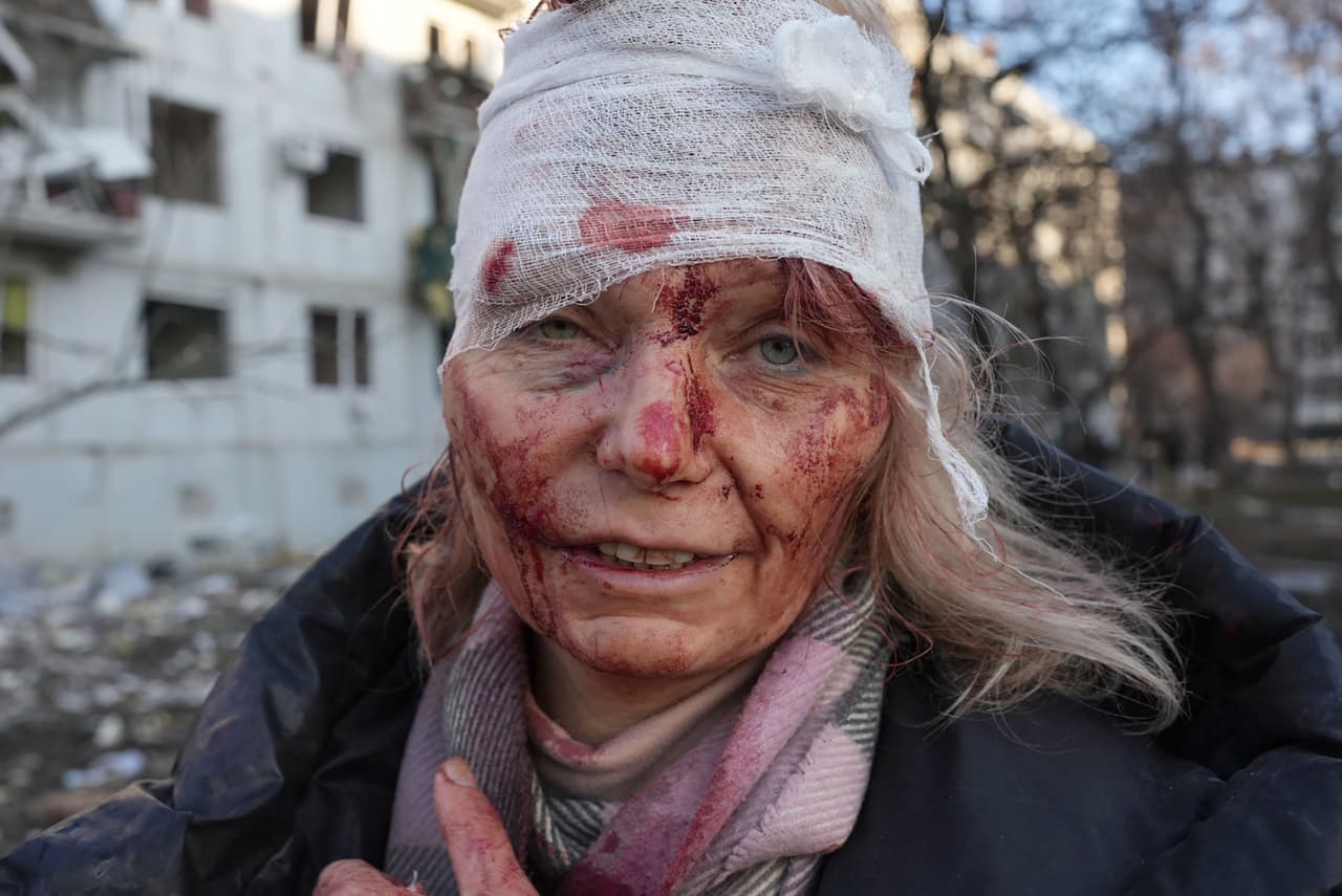 Olena Kurilo es una maestra de 52 años que resultó herida en un ataque aéreo ruso a un complejo de apartamentos en Kharkiv, al este de Ucrania, el 24 de febrero.
<br>
<br>El Servicio de Emergencias de Ucrania indicó que más de 2,000 civiles han muerto desde que empezó el conflicto y la oficina de derechos humanos de Naciones Unidas ha registrado 136 muertes de civiles, pero advirtió que la cifra total sería mucho mayor.
<br>
<br>
<a href="https://www.univision.com/noticias/mundo/horror-conflicto-rusia-ucrania-invasion-siete-dias-fotos"><u>Vea aquí las fotos del horror de la guerra en Ucrania a una semana de la invasión rusa</u></a>
<br>