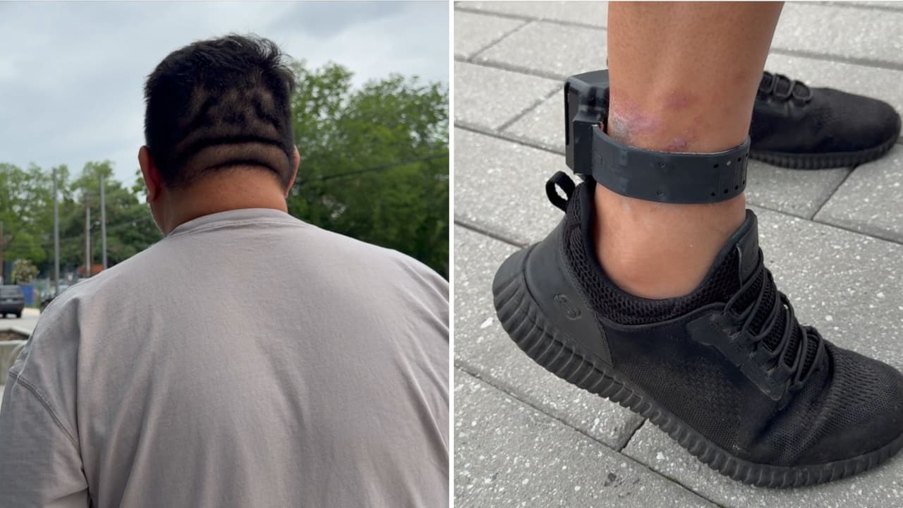 “No quiero perder mi pie”: inmigrante con diabetes denuncia infección por grillete de ICE