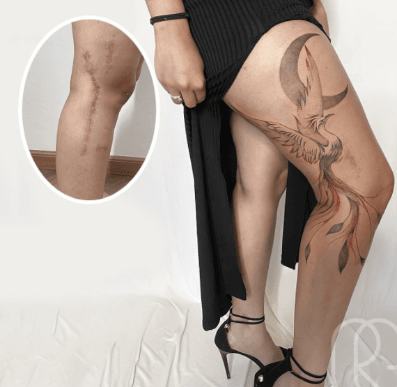 Gauthier no sólo transforma cicatrices en arte, también aprende de personas increíbles, tal como describe en cada una de sus publicaciones. 
<br>
<br>A esta joven de 21 años le tatuó un ave fénix en su marca que le quedó luego de haber sufrido un accidente de tránsito en 2018. "A veces parece que es el fin del mundo y sólo se entiende ahí enfrente”.