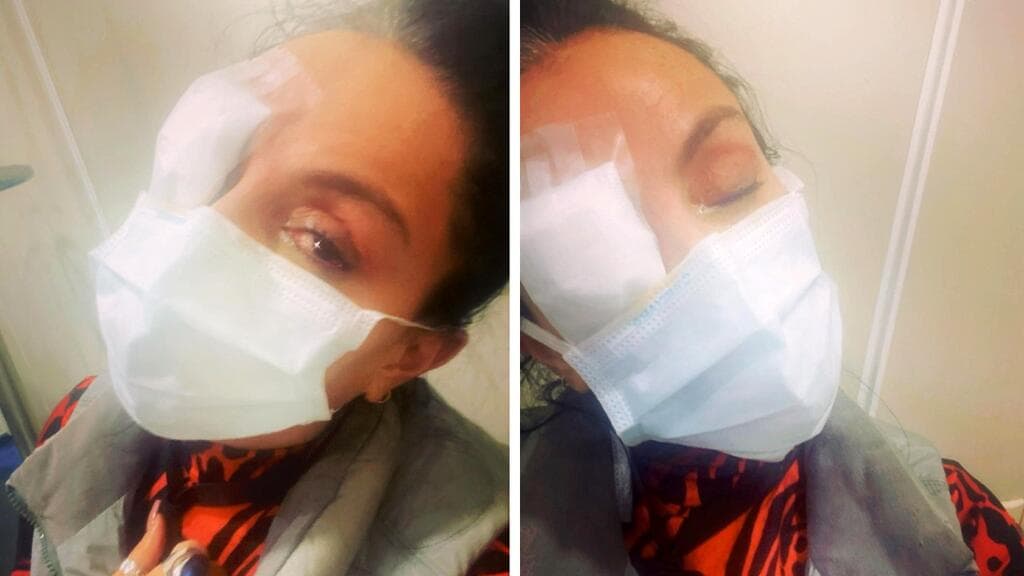 Ivonne Montero apareció así en Instagram tras sufrir un accidente en sus córneas.