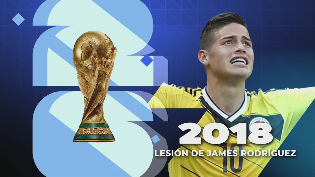 Rusia 2018: La lesión de James Rodríguez
