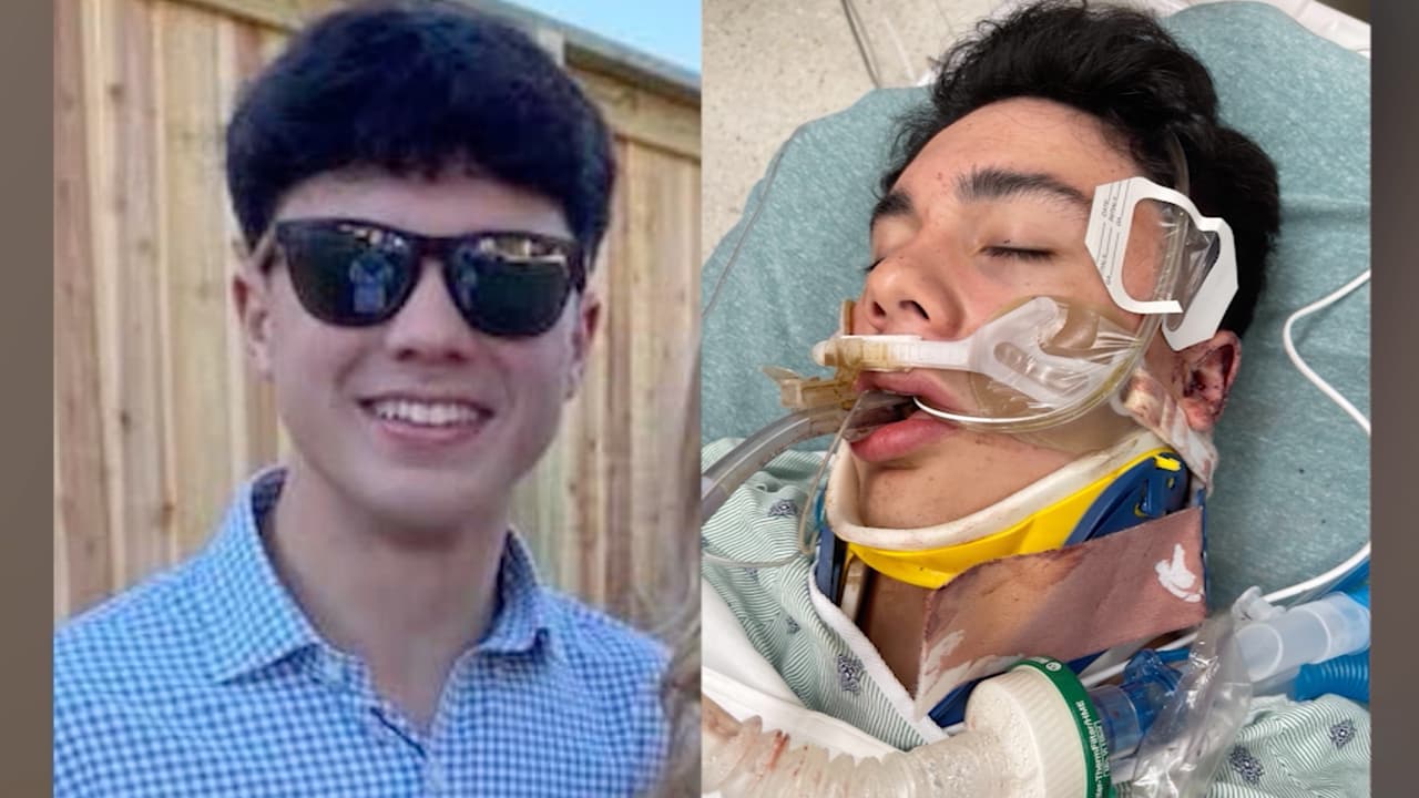 Después de estar hospitalizado, Hagan está de regreso en casa, pero le espera una larga recuperación, dijo su hermano en redes sociales.