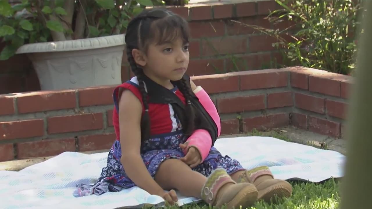 La comunidad de Los Ángeles se desborda para ayudar a la niña con “huesos de cristal”