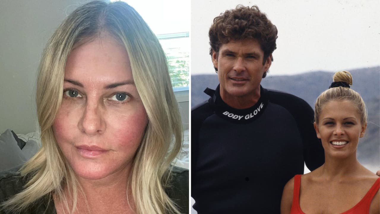La actriz Nicole Eggert, famosa por su participación en ‘Baywatch’ al lado de David Hasselhoff, padece cáncer de mama.