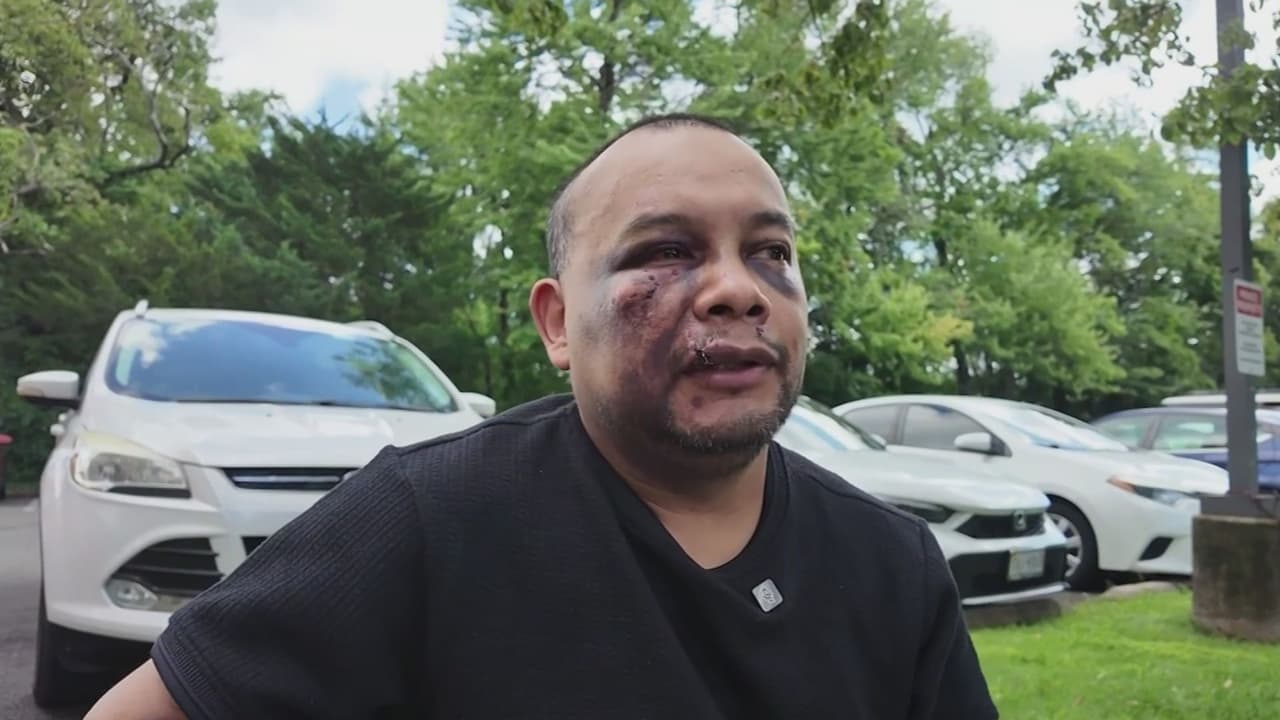 "No sé realmente lo que pasó": Inmigrante hospitalizado tras operativo de ICE en Virginia podría solicitar Visa U