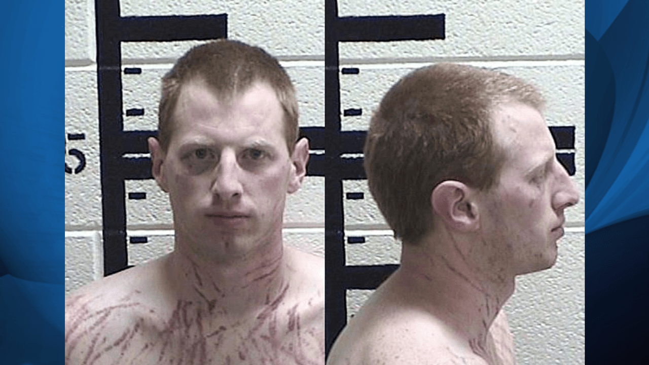 Acusan de violación a exguardia de prisión de Georgia; lo fotografían rasguñado