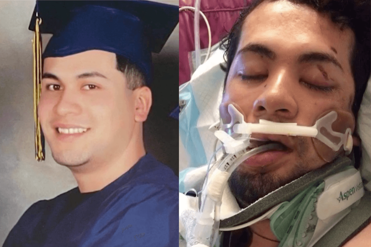 “Estamos esperando un milagro”: madre del joven que resultó herido tras un presunto caso de abuso policíaco