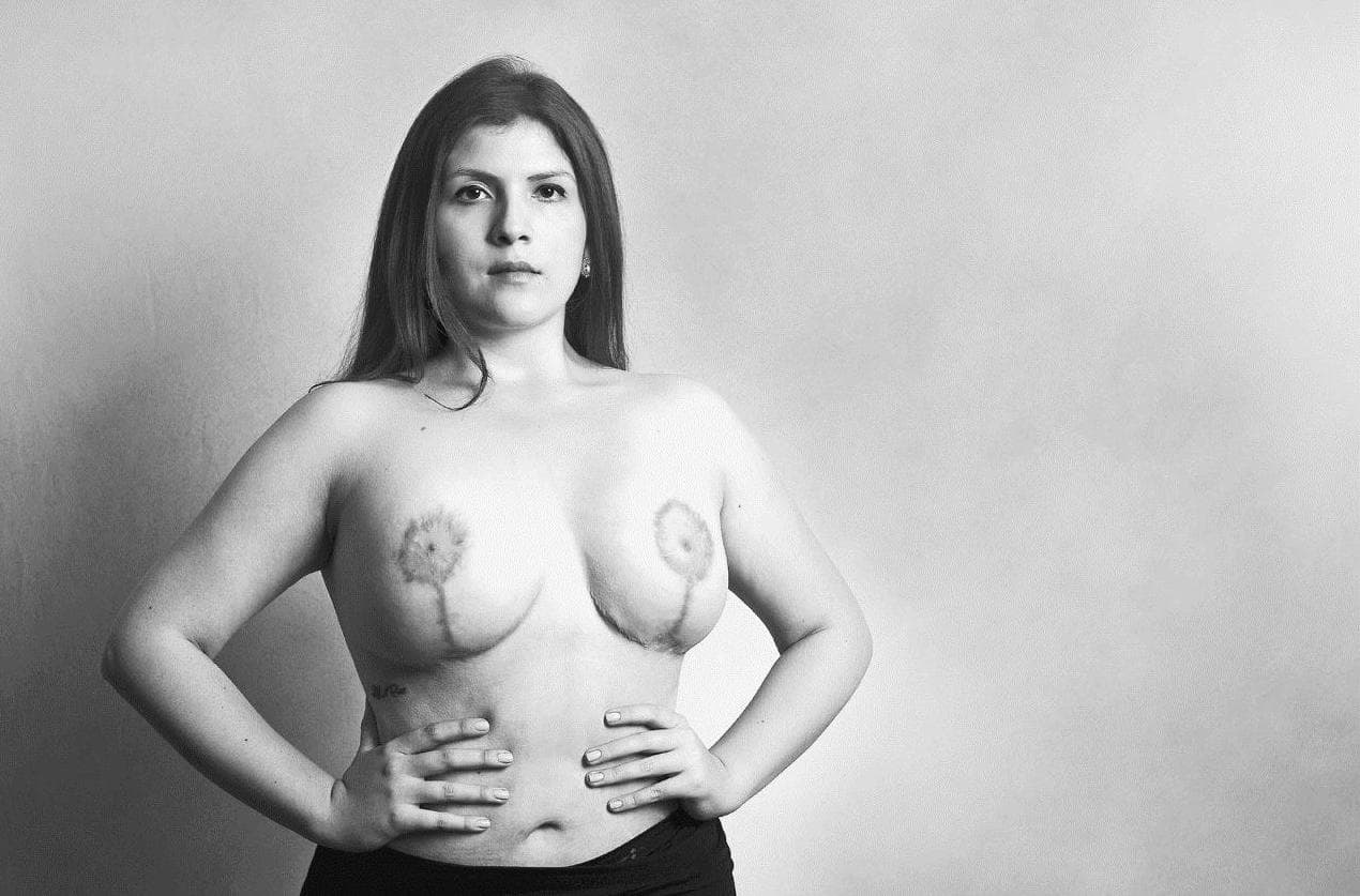 In Colombia, increasing calls for reform to plastic surgery laws