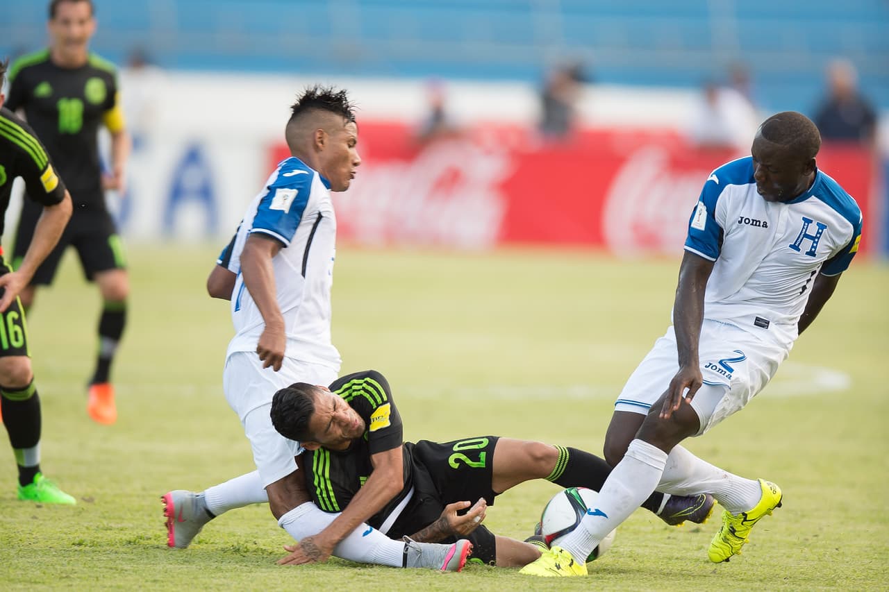Nunca se desea ver que un futbolista sufra una lesión de todo tipo, menos cuando sucede una fractura de la magnitud sufrida por el hondureño Luis Garrido.