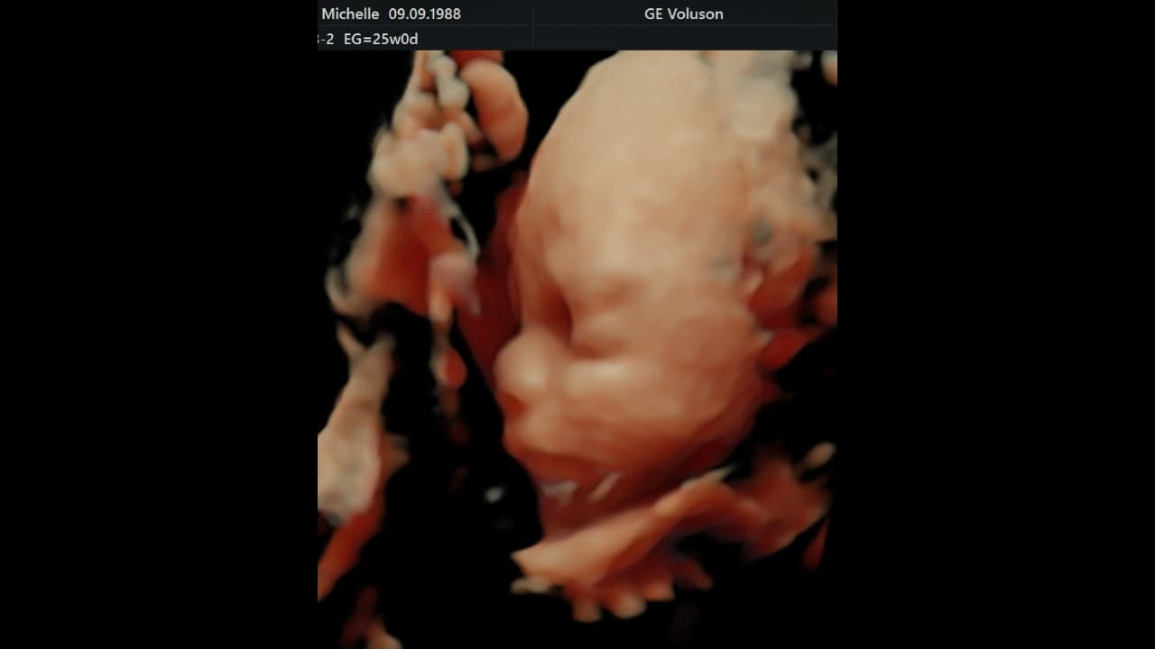 Así luce Milo, hijo de Michelle Renaud y Matías Novoa