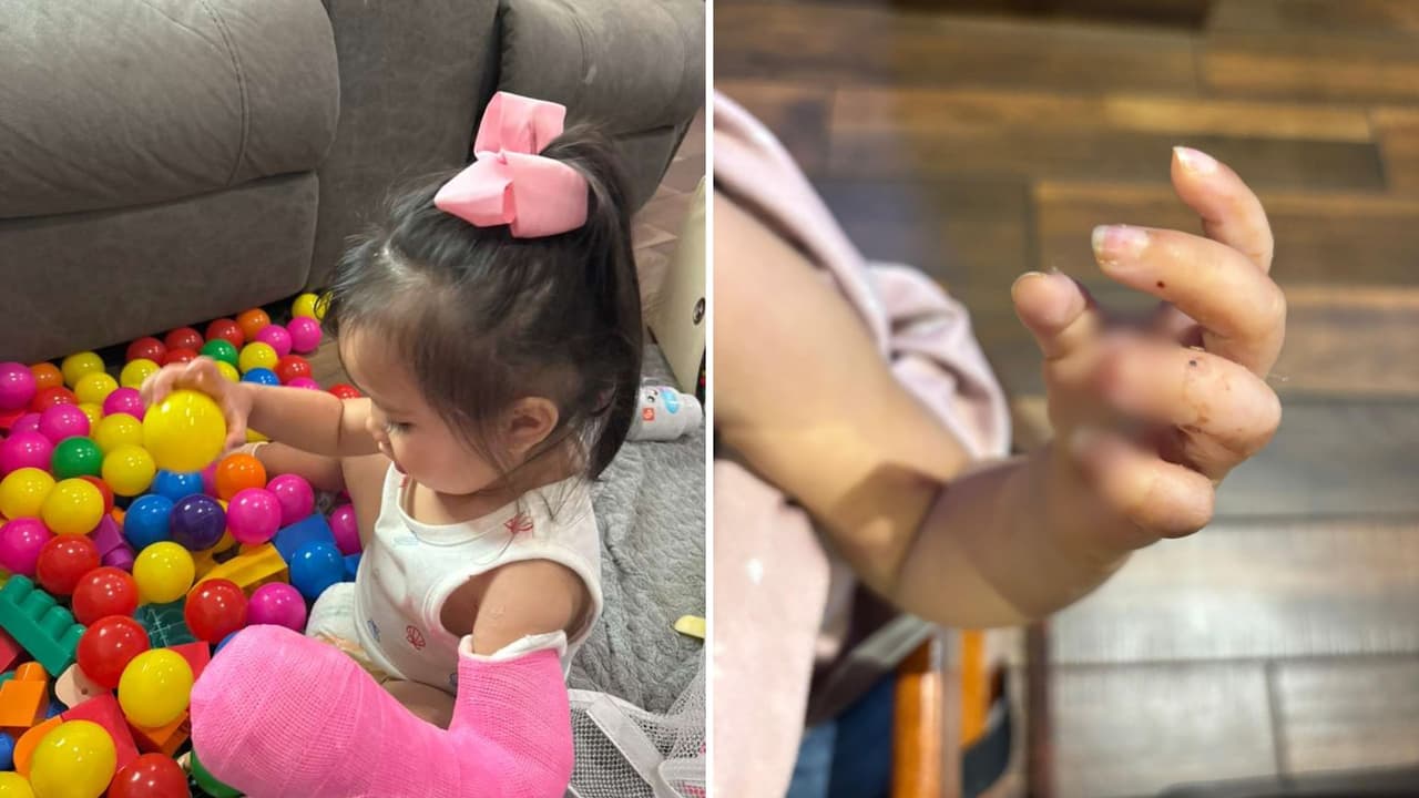 Niña sufre semiamputación en guardería de San Antonio; madre cuestiona desaparición de videos de seguridad