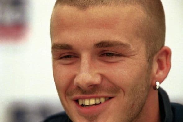 Nadie se imaginaba que algún día el futbolista inglés, David Beckham, sería uno de los hombres más buscado por las mujeres, pues tenía una terrible sonrisa.
