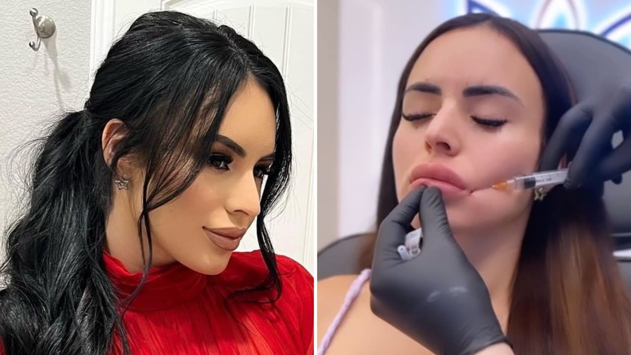 Novia de Toni Costa se somete a doloroso procedimiento en los labios: así cambió su aspecto