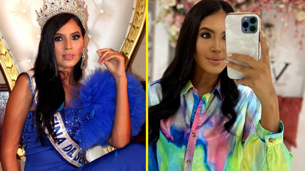 Muere exreina de belleza de Venezuela a los 24 años: una cirugía le arrebató la vida