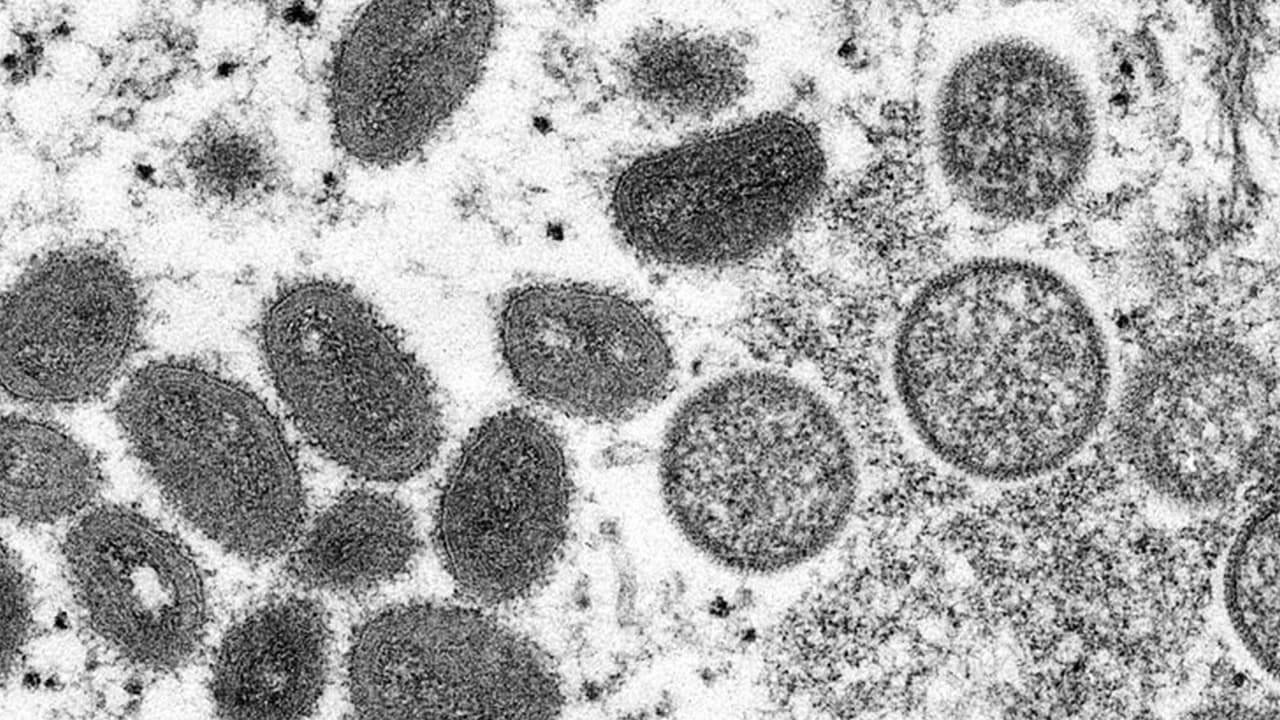 ¿Qué es el monkeypox o viruela del mono? Esto es lo que debes saber
