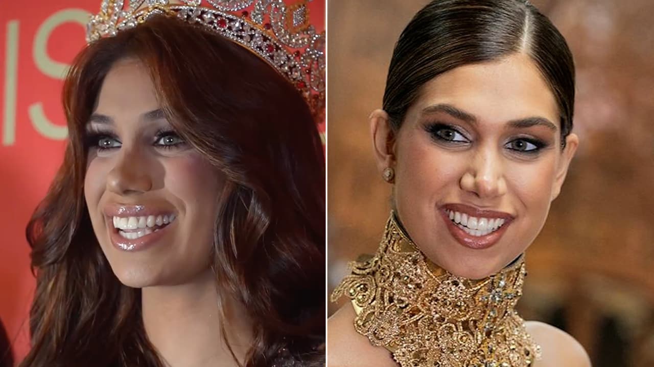 Lina Luaces se somete a tratamiento: así se prepara para Miss Universo