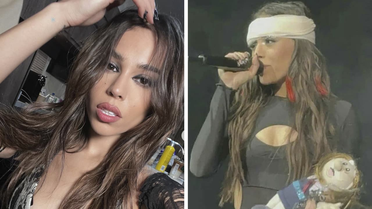 Así fue el accidente que sufrió Danna Paola en pleno concierto que le provocó un gran "chipote"