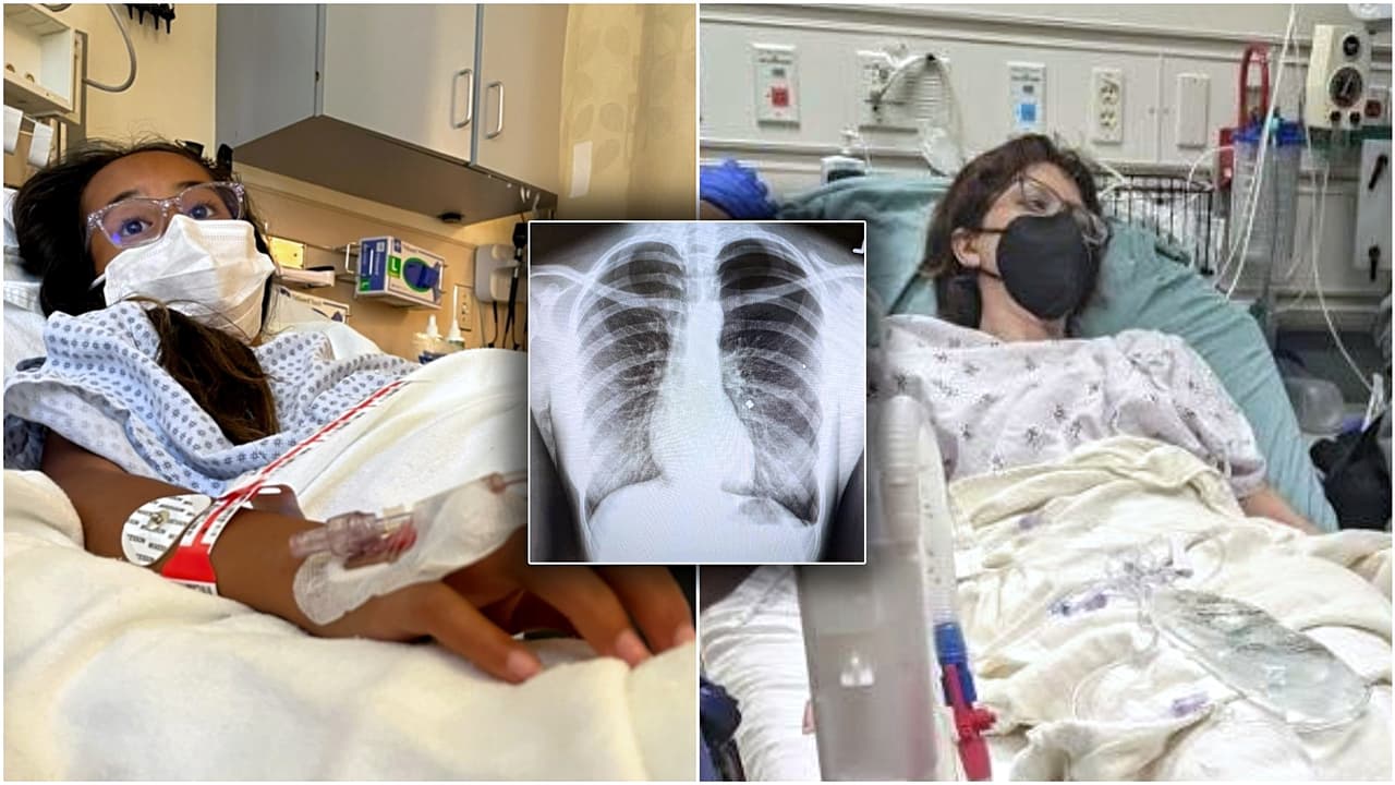 Ataques a niñas con pistolas de perdigones ponen en alerta a la Policía sobre nuevo reto viral de TikTok