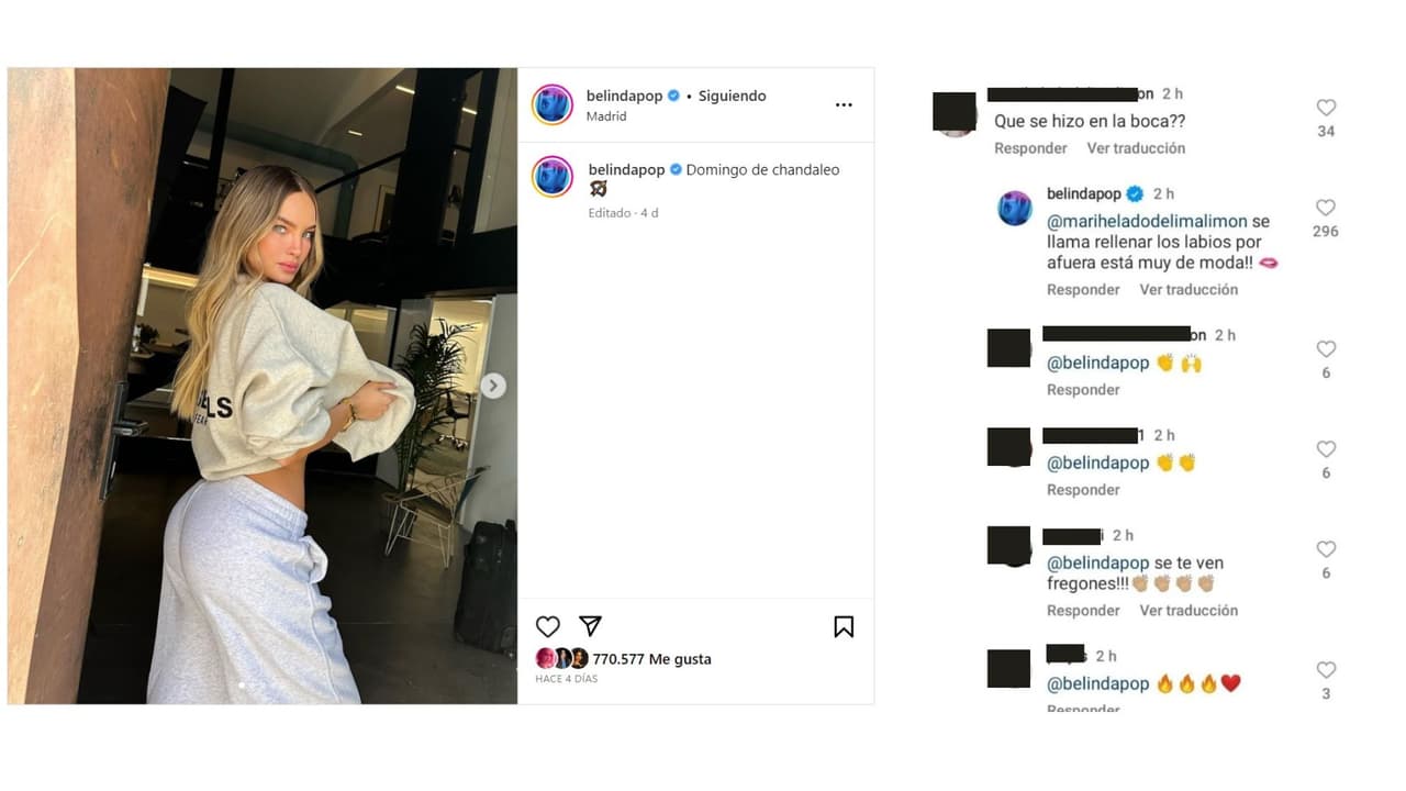 Belinda respondió sobre cómo logra el aspecto de sus labios, pero después deshabilitó los comentarios en Instagram.