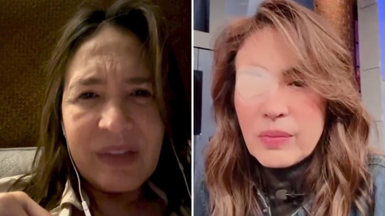 ¿Qué es la ELA, enfermedad que padece Yolanda Andrade?: su esperanza de vida sería de cinco años