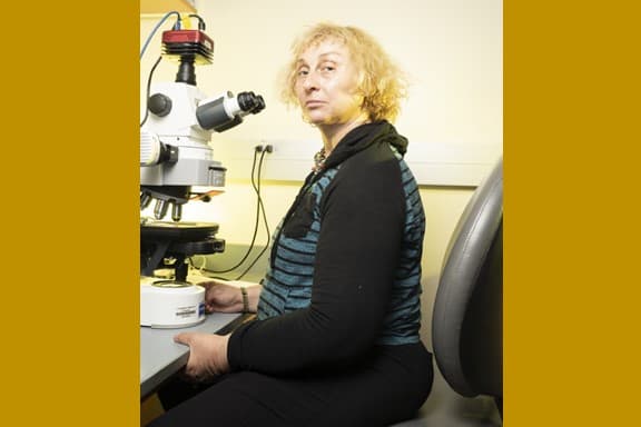 Científicos de Berkeley buscan en la sangre la respuesta a las enfermedades causadas por el envejecimiento