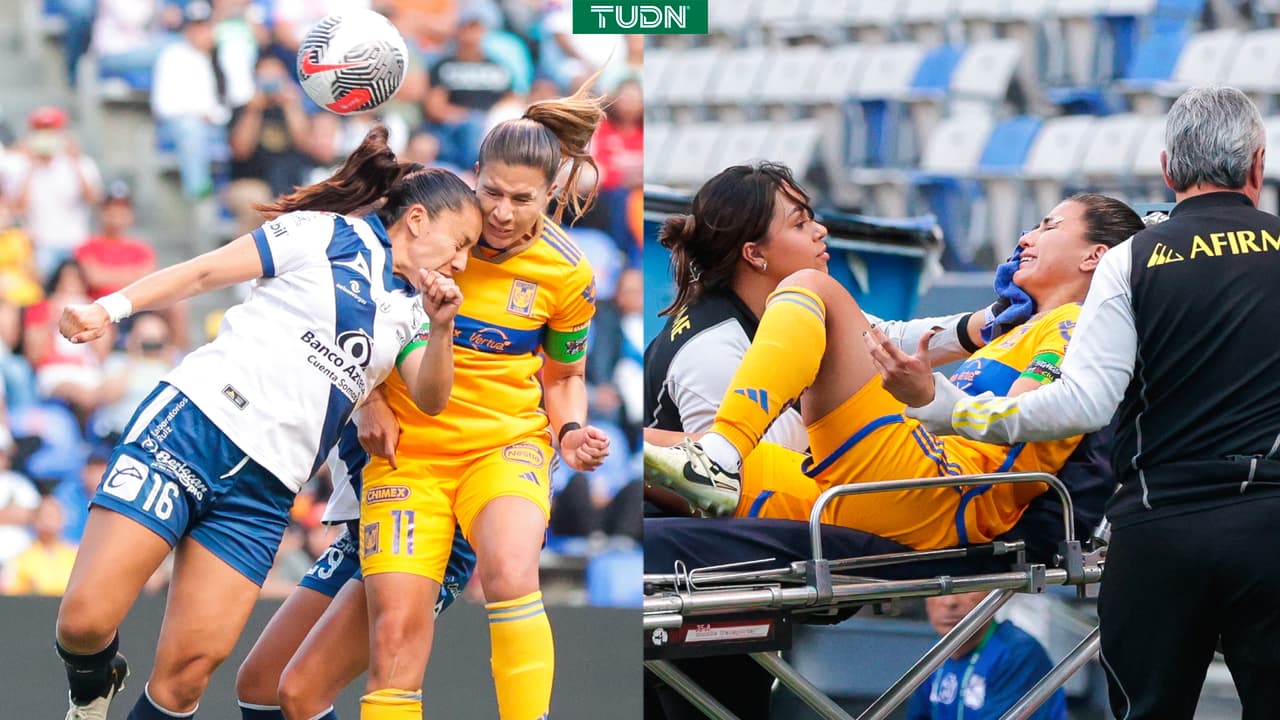 Nayeli Rangel sufre fractura en la cara en el Puebla vs. Tigres