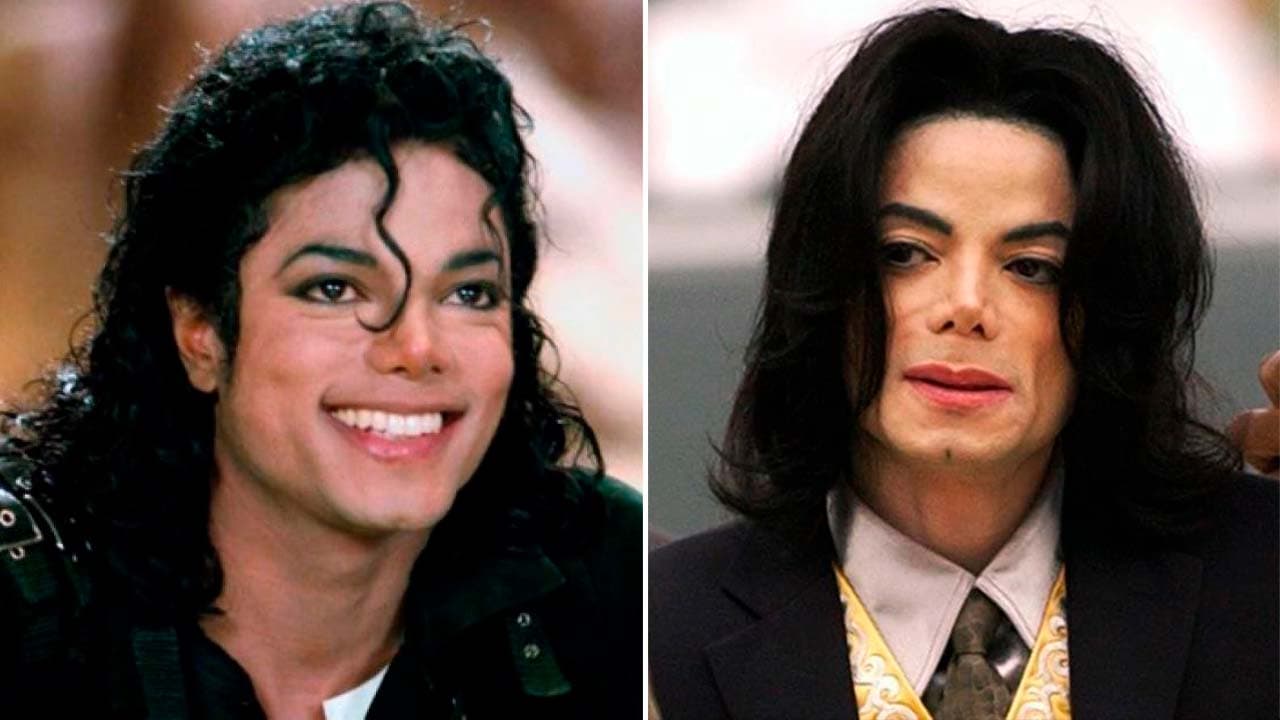 Michael Jackson era calvo y nadie se dio cuenta: usó pelucas por 25 años, a raíz de un accidente