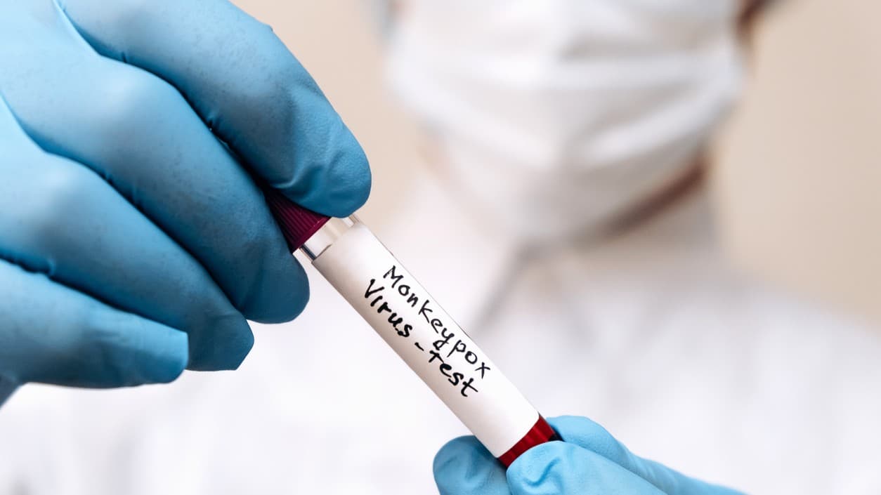 Por qué la OMS quiere cambiarle el nombre a la viruela del mono 